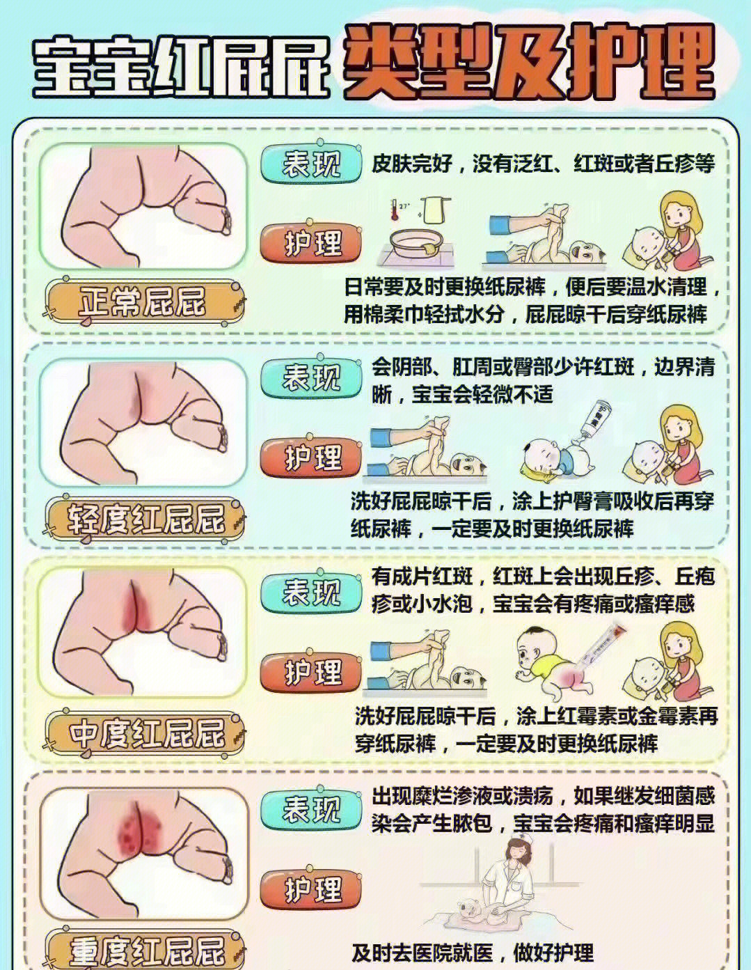 漳州月嫂教你正确护理宝宝屁屁红屁屁护理