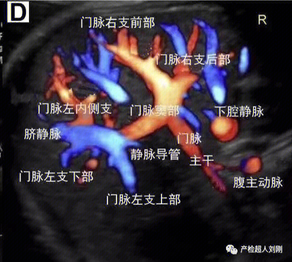 肝门静脉超声解剖图图片