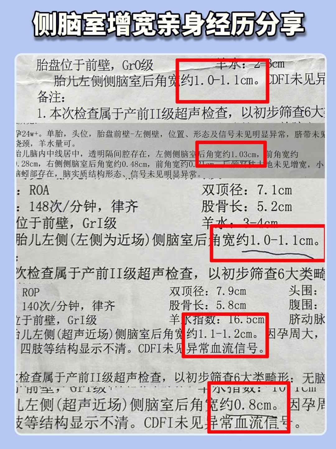 侧脑室增宽没有那么可怕74别被吓倒了 6015