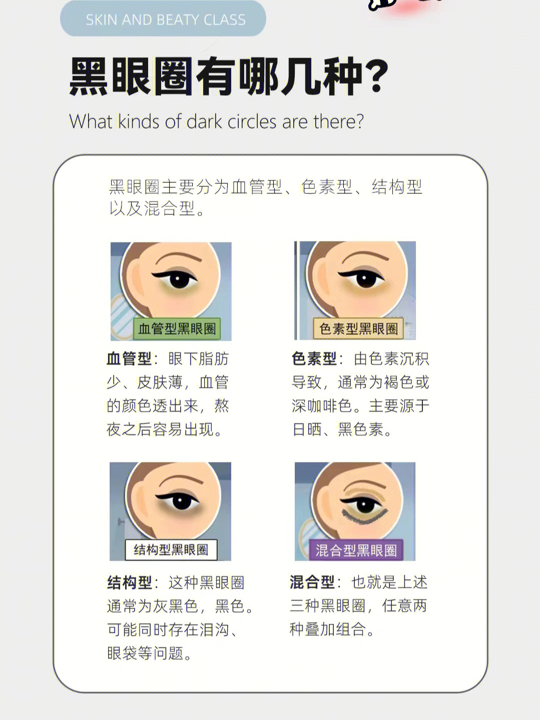 黑眼圈颜色分类图片