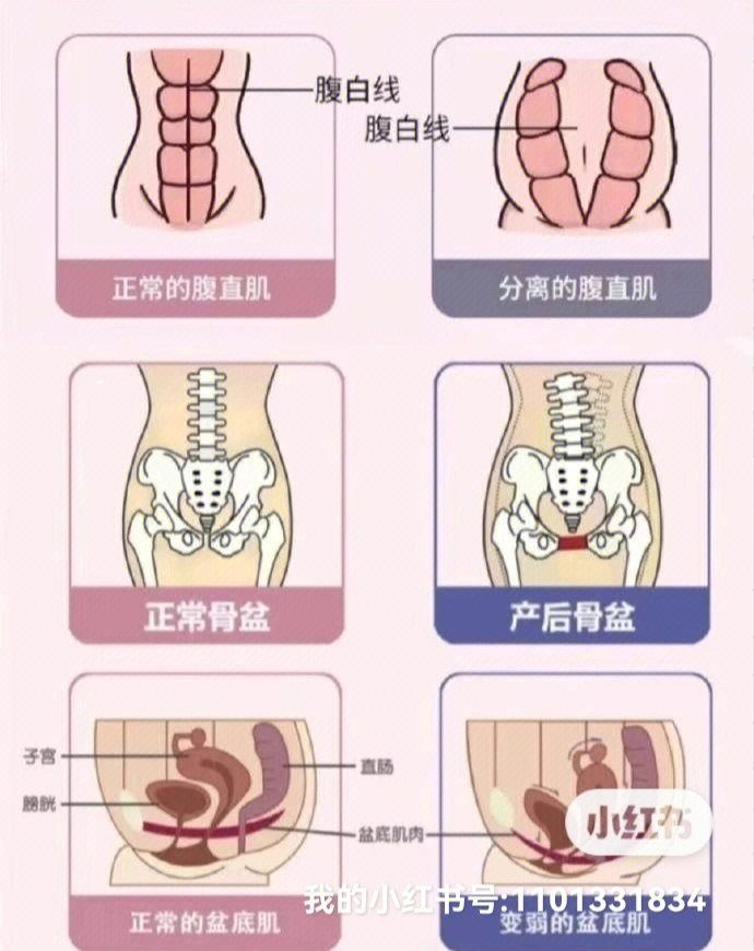 超全产后腹直肌骨盆盆底肌修复攻略