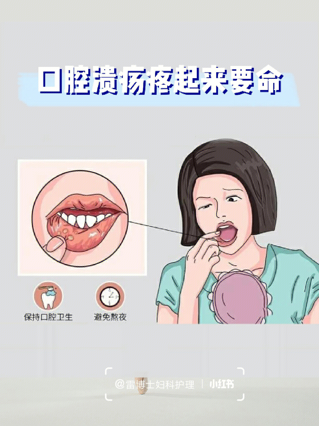 口腔上颚溃疡怎么治疗图片