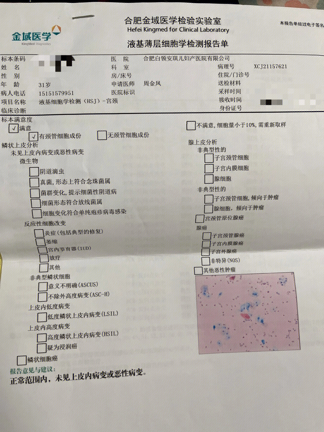 宫颈筛查正常图片