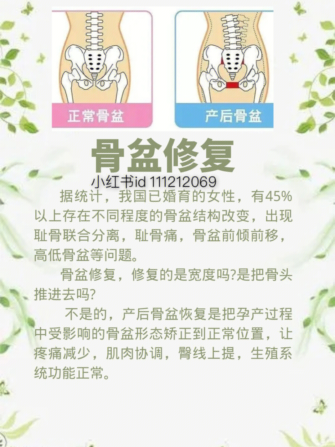 产后骨盆修复有必要吗图片