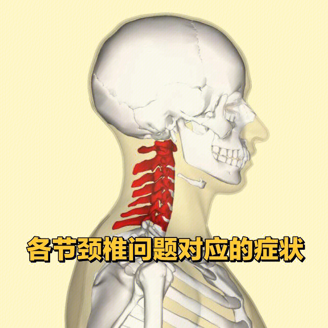 颈椎五六七节压迫神经图片