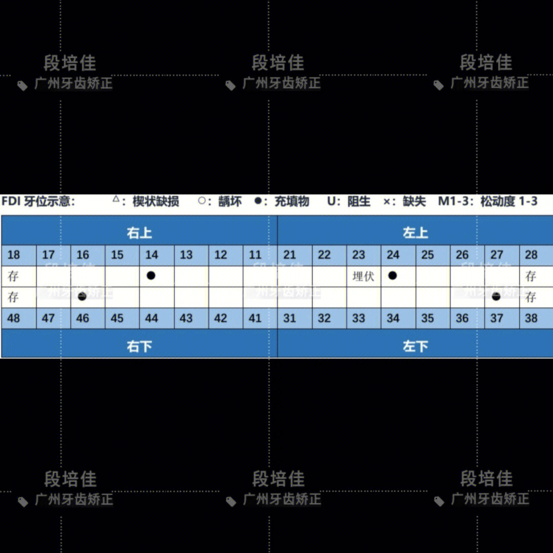 托槽定位数值图图片