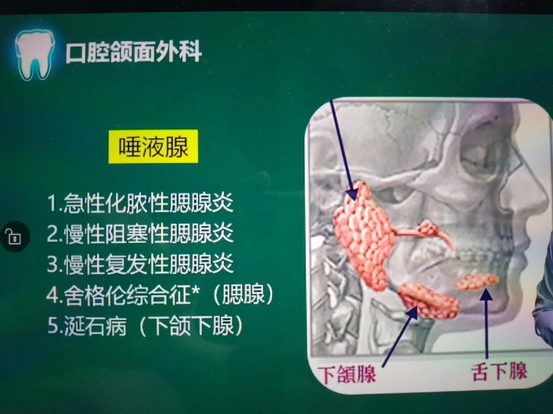 腮腺导管口发炎的症状图片