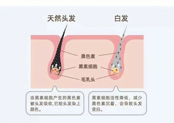 年轻人为什么会长白头发如何预防白发02