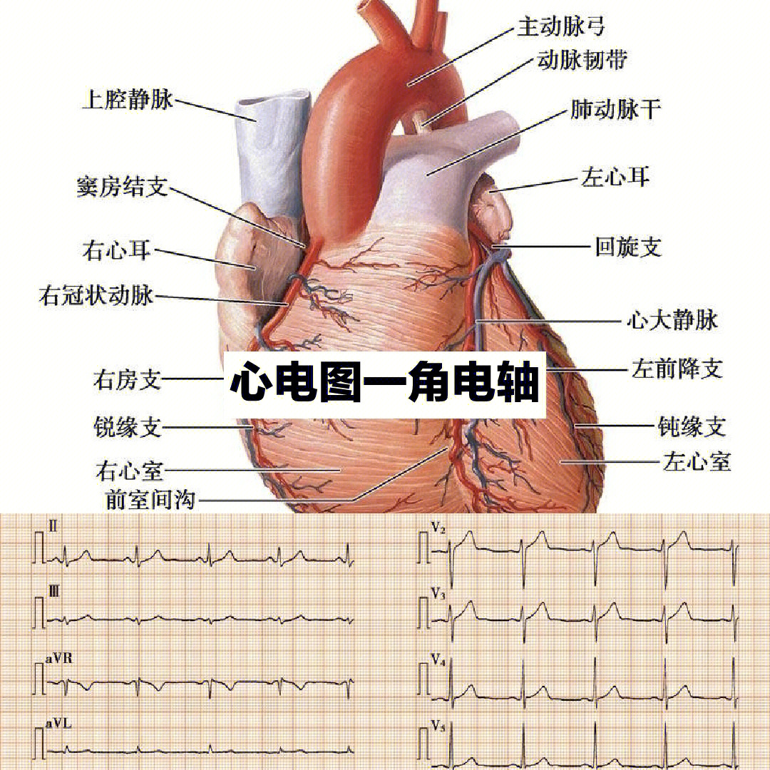 心电轴怎么画图片