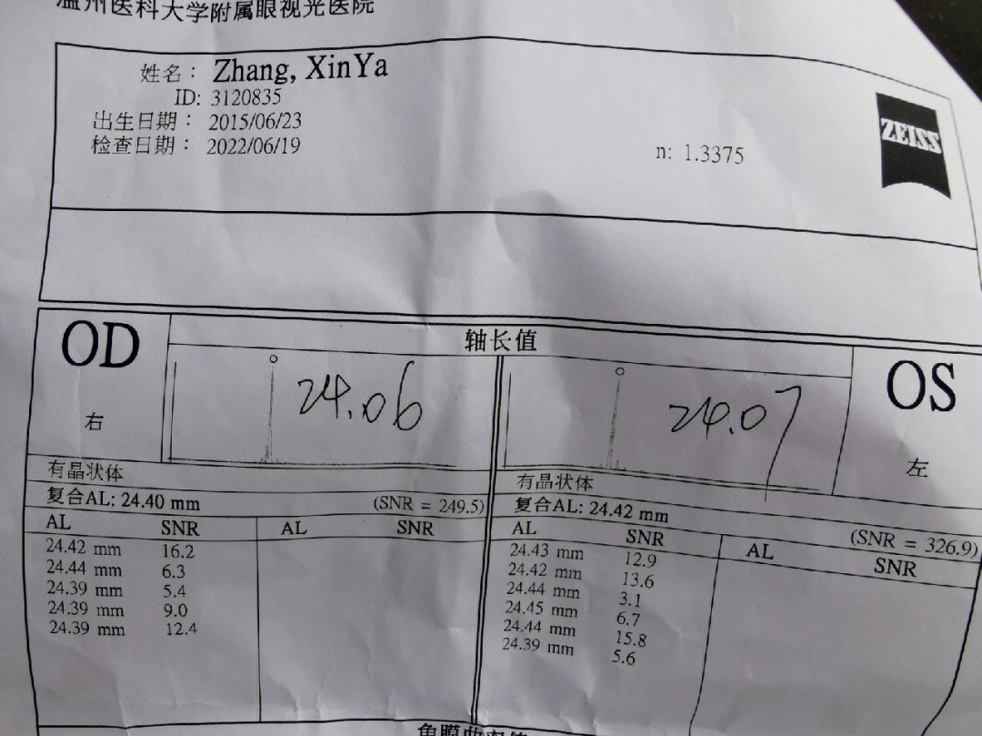 16岁眼睛近视500度图片