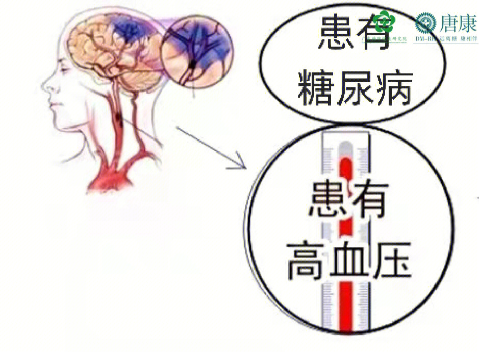 高血压会引起什么病症图片