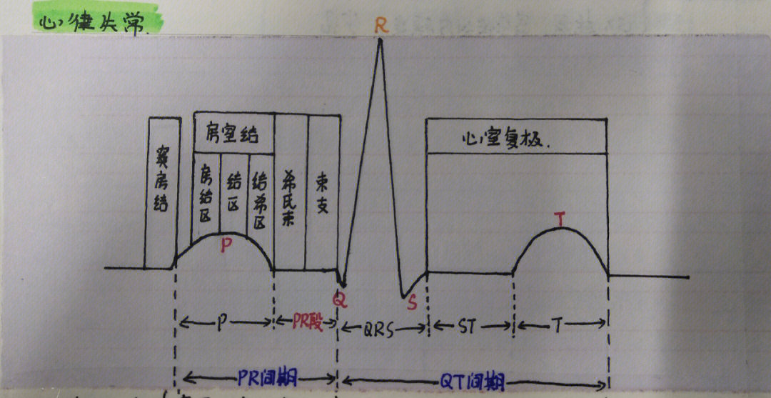 心电图基本读图步骤