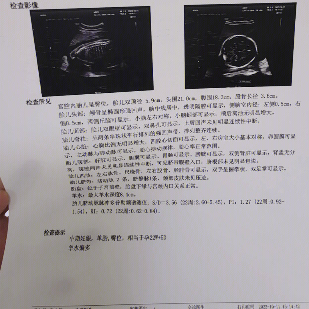 大排畸单子图片