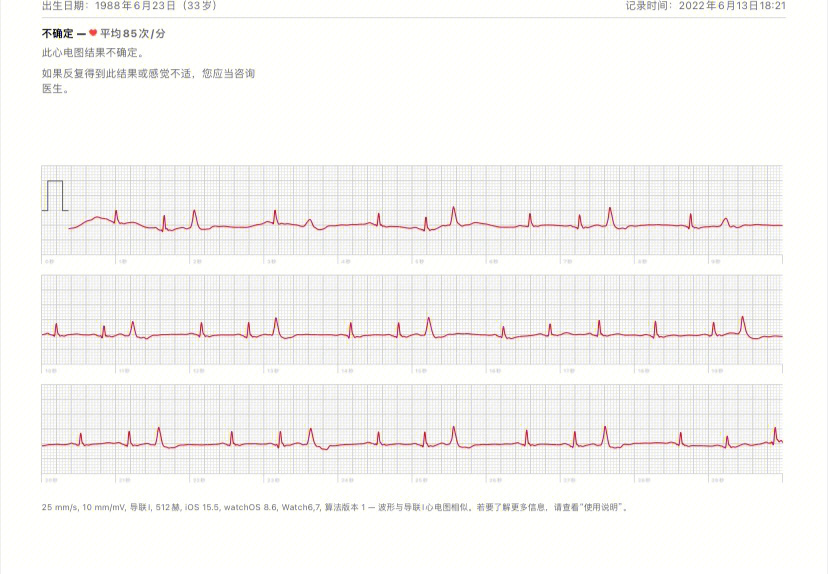 频发室早各种三联律二联律熬夜74咖啡74坏脾气74