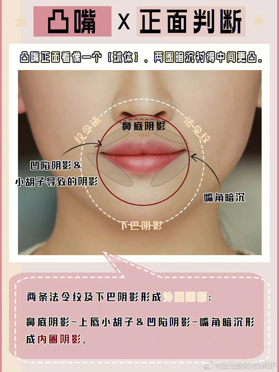 嘴巴突出怎么改善图片