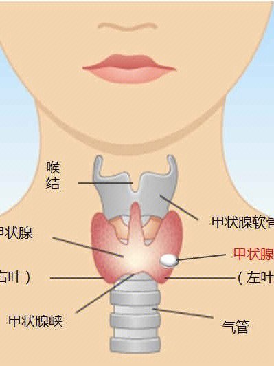 嗓子结节图片