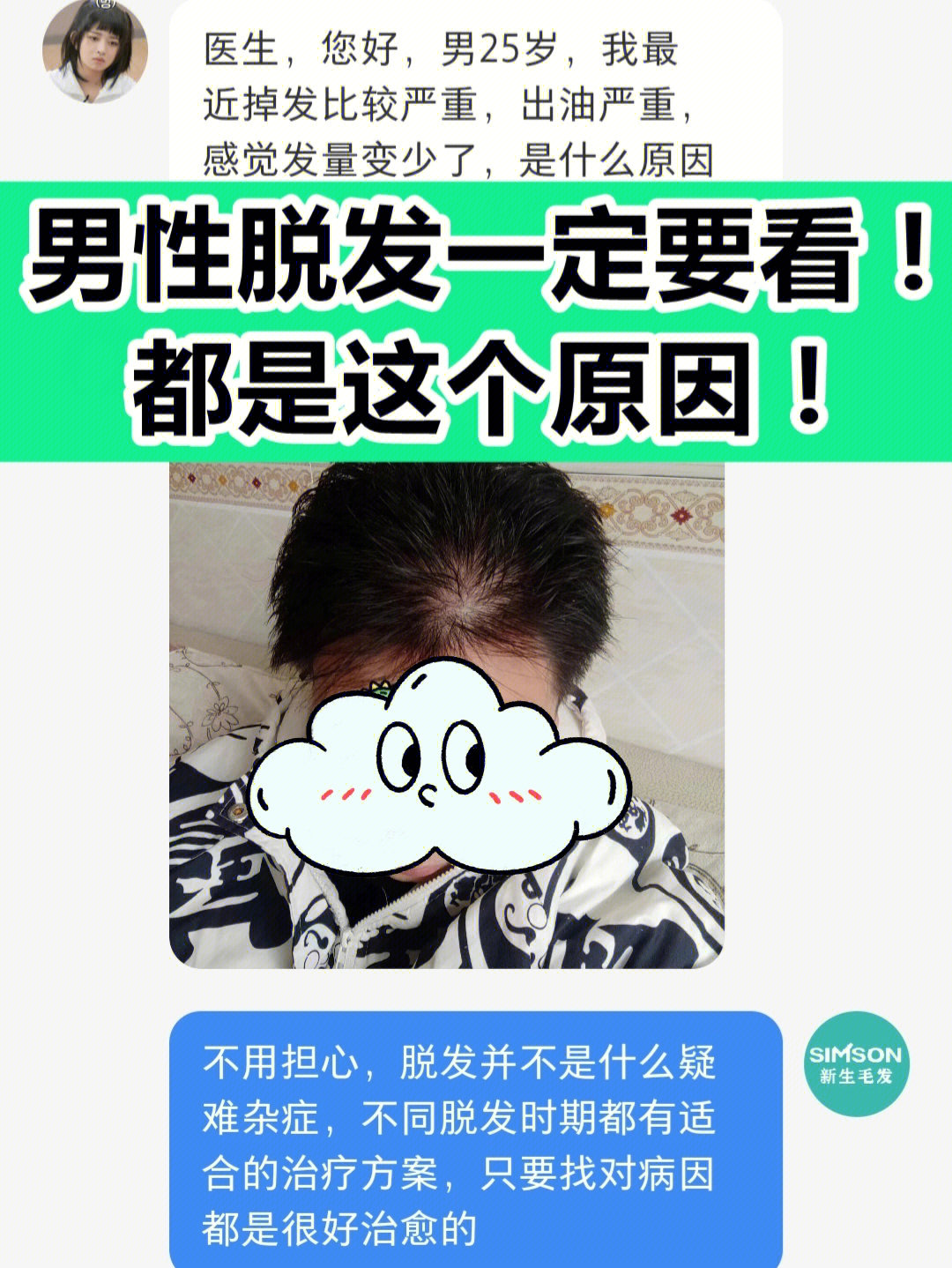 男性脱发一定要看60都是这个原因72