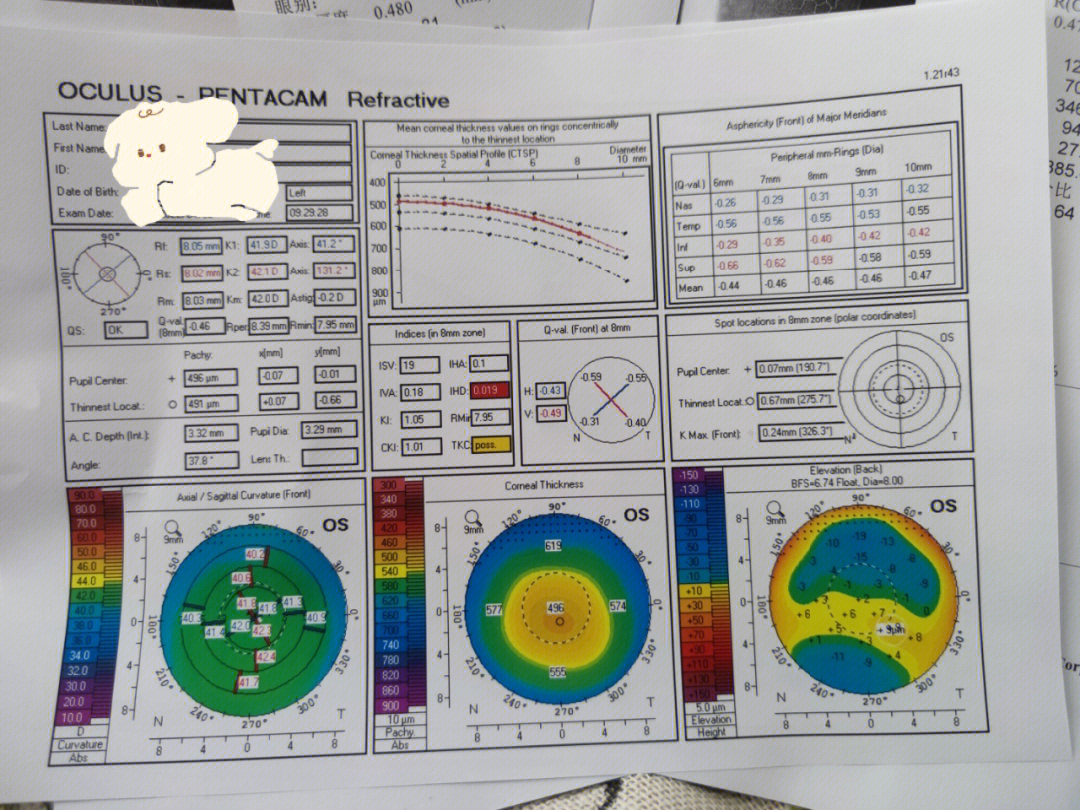 第二次去测角膜细胞和曲率(8点20到,排队1小时),眼压(16正常),暗瞳(7