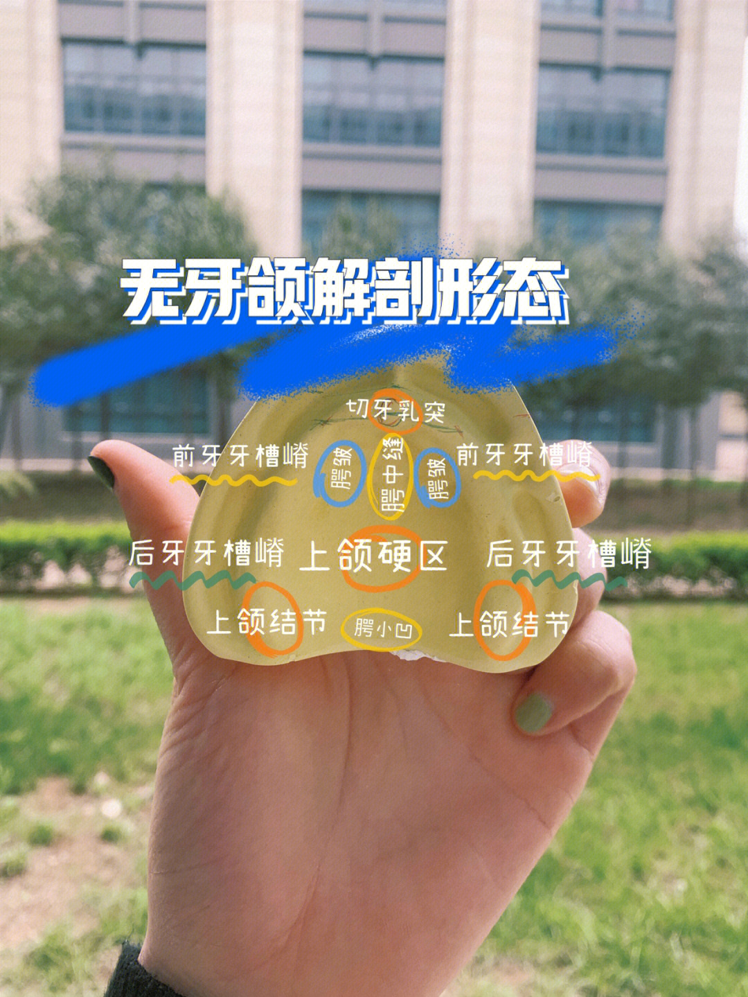 0404当牙列缺失后,上下颌骨的改变主要是牙槽嵴的萎缩,随着牙槽嵴