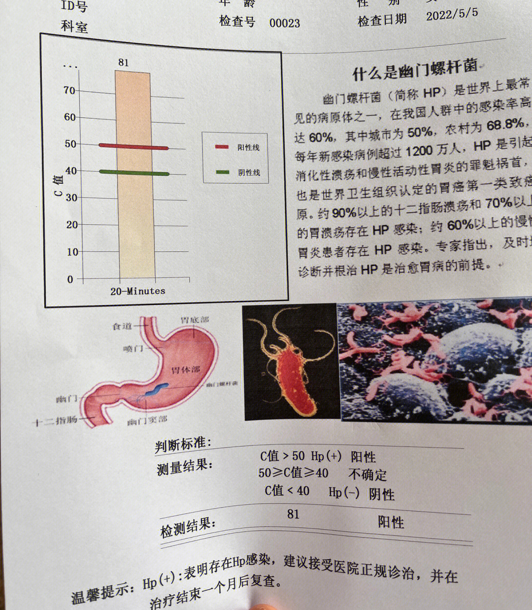 幽门螺旋杆菌正常数值图片