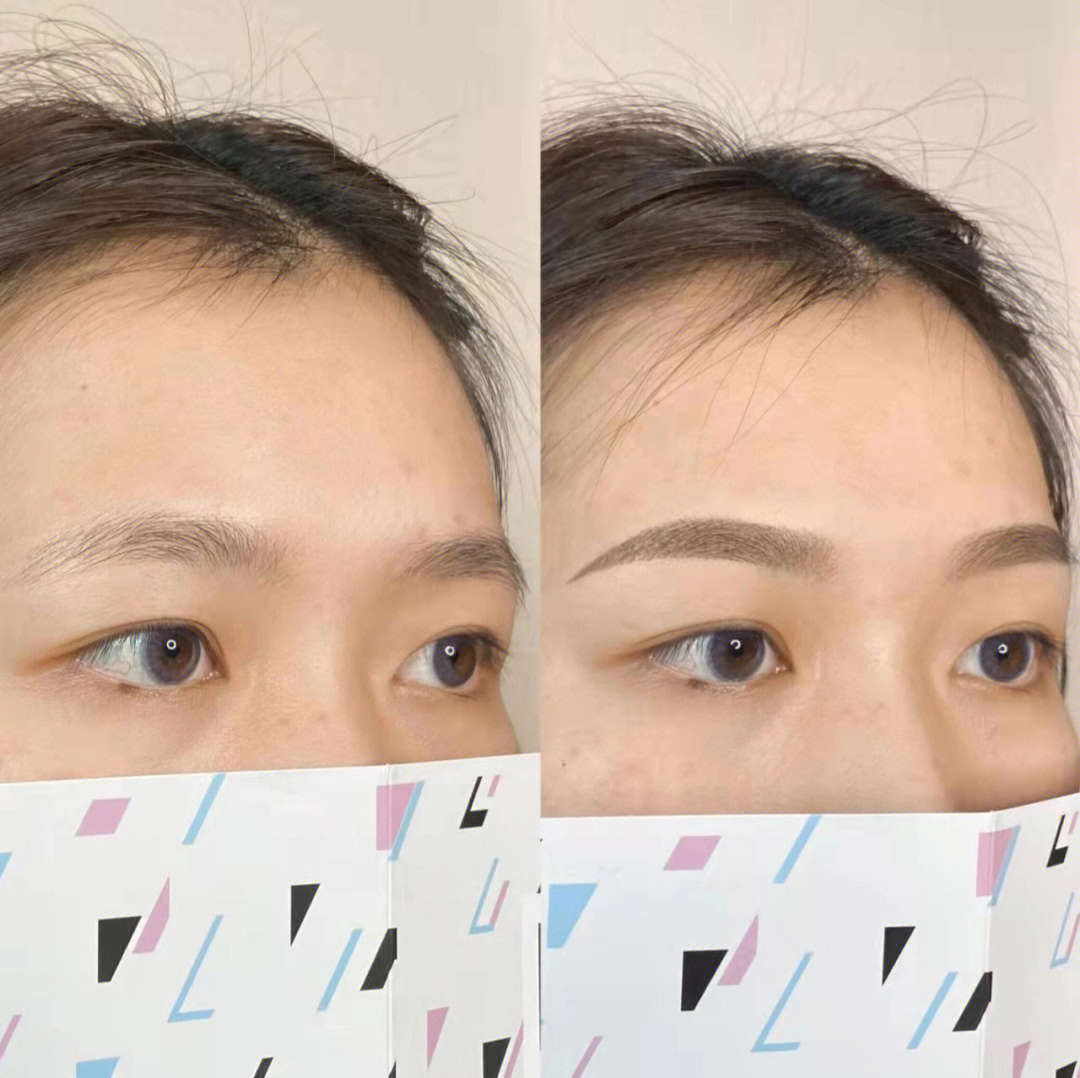 纹眉后1至30天的变化图图片
