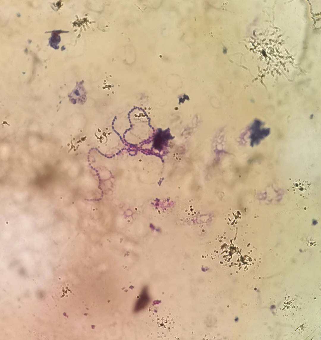 伤寒杆菌鞭毛染色绘图图片