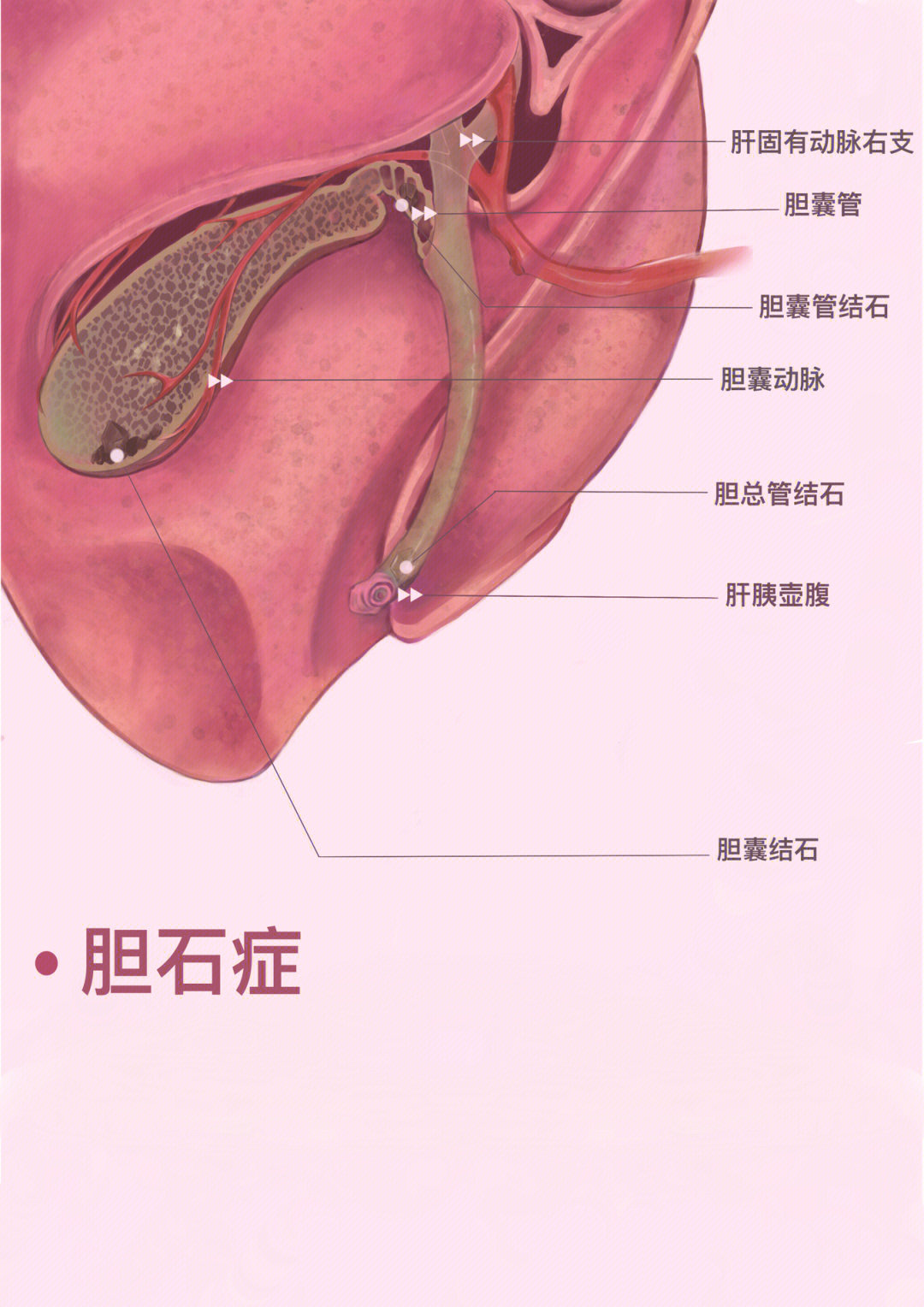 胆囊壁分层解剖图片