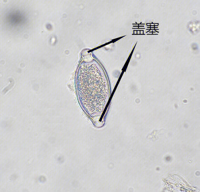 肝吸虫卵形态描述图片