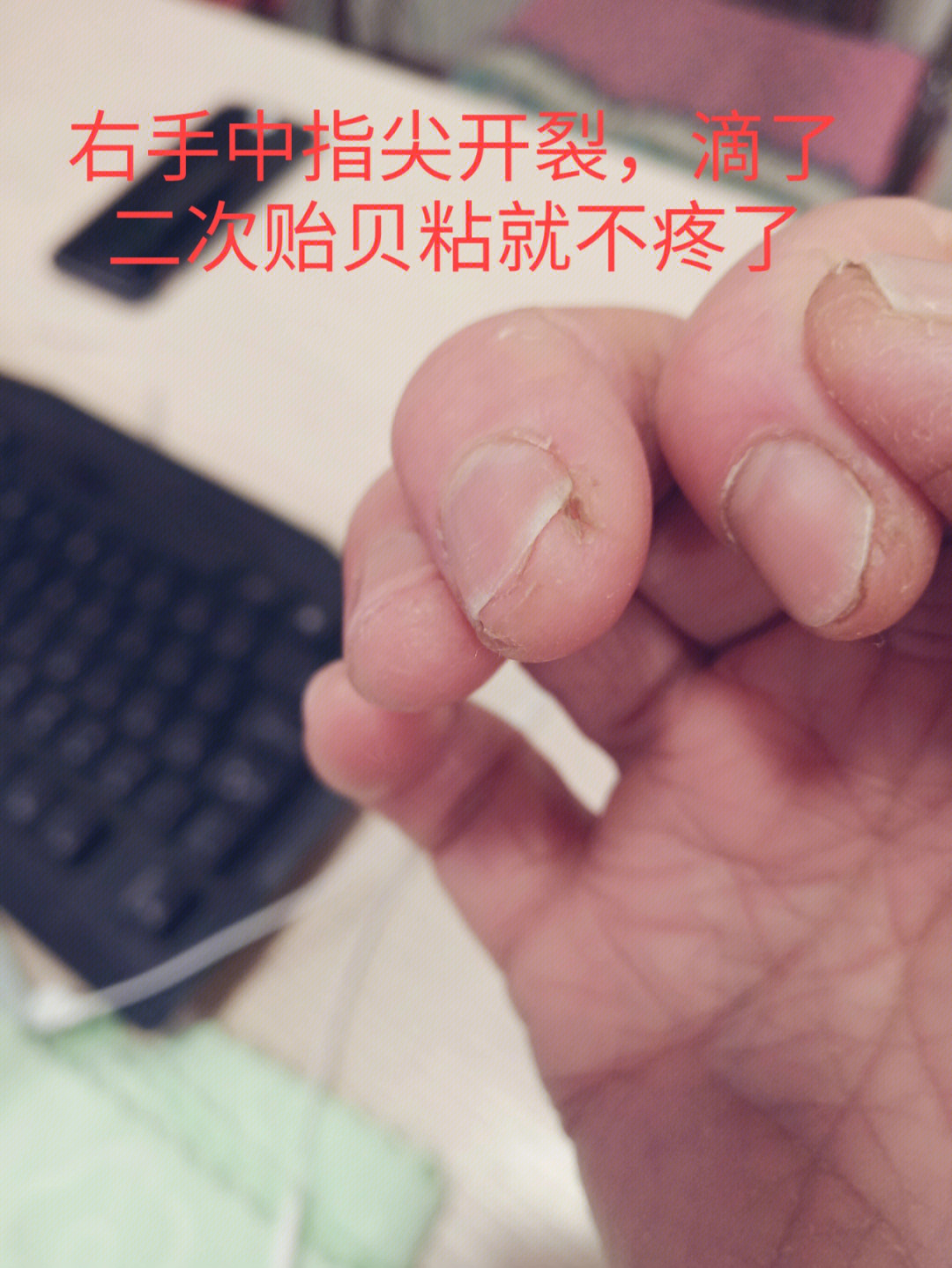 贻贝粘蛋白～修复皮肤黏膜杠杠滴91