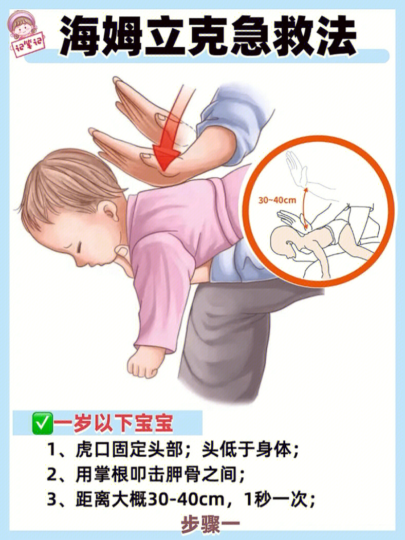 海姆立克急救法4~7岁图片