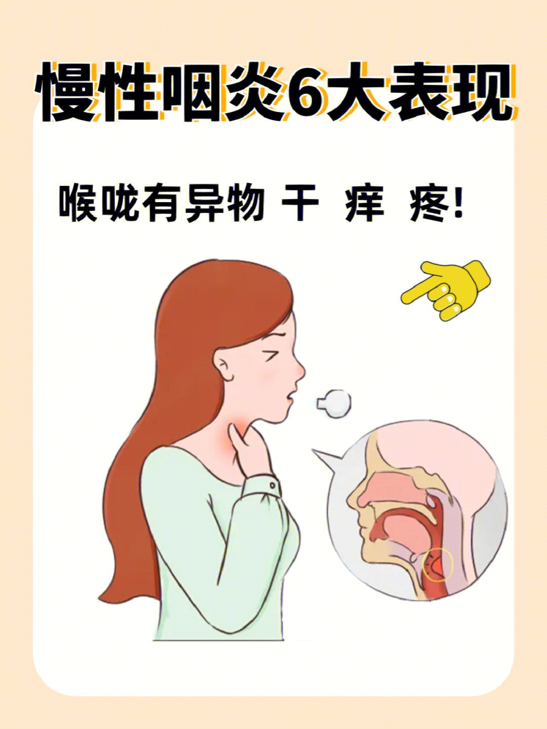 慢性咽炎的症状表现图片