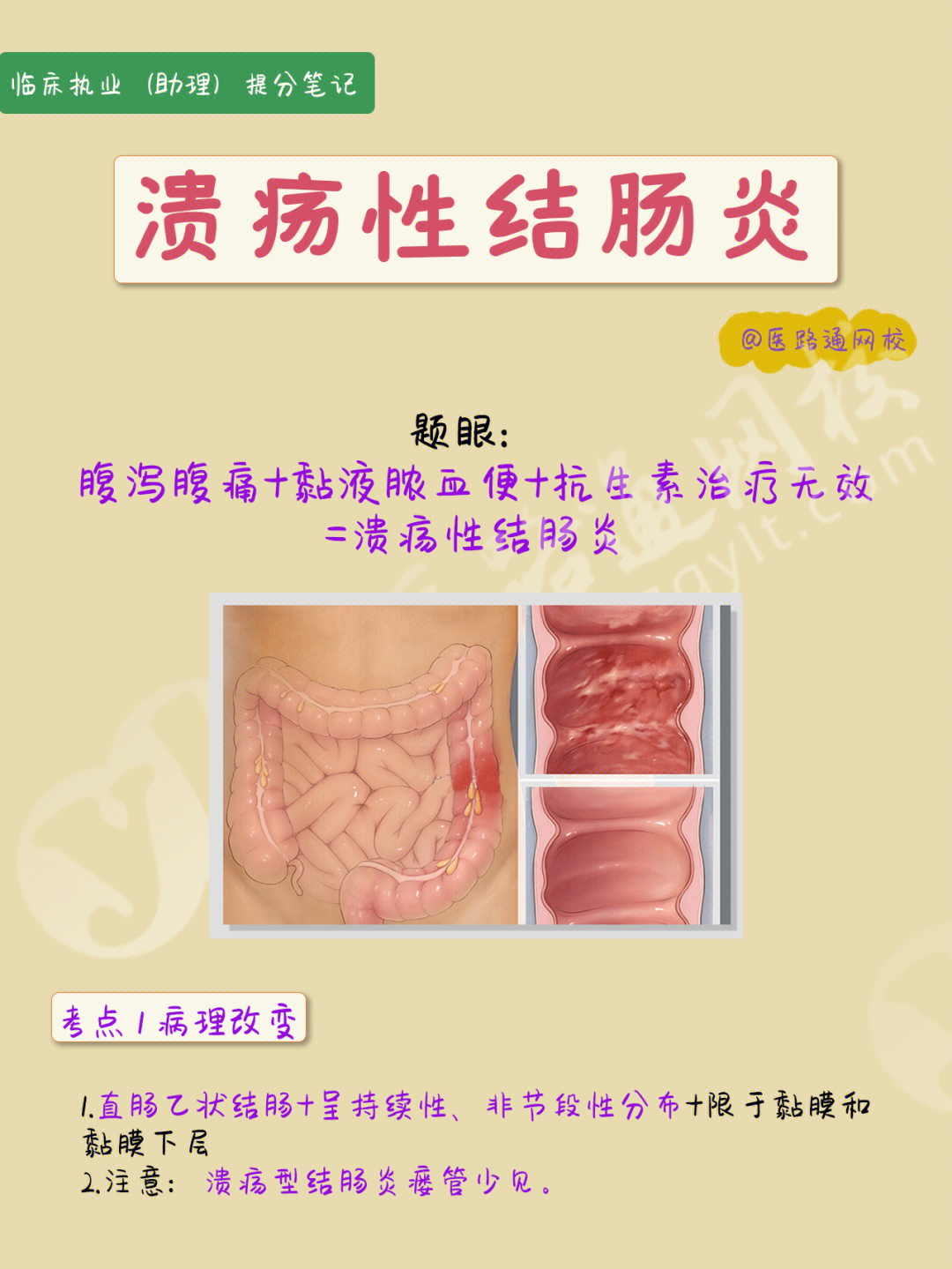 结肠炎疼痛位置图图片