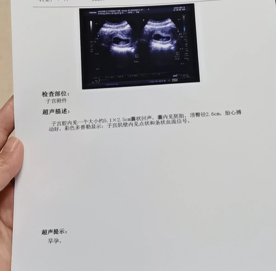 怀孕9周彩超图片图片