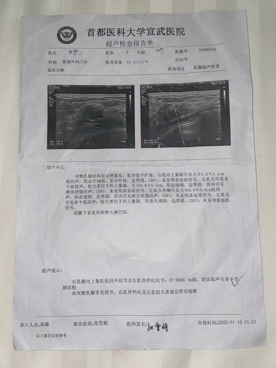 乳腺结节4b翻盘伴钙化内见血流信号