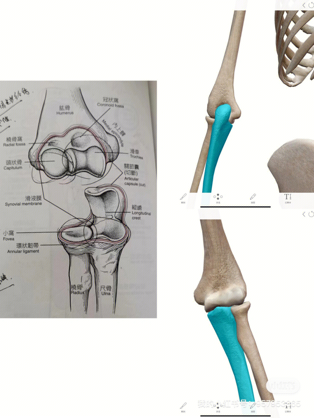 在前面更新了骨性之后,可以把肘关节理解成三个:肱骨