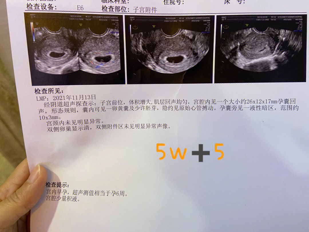 第一次是因为有褐色分泌物,b超显示孕囊旁积液,医生诊断先兆流产也说