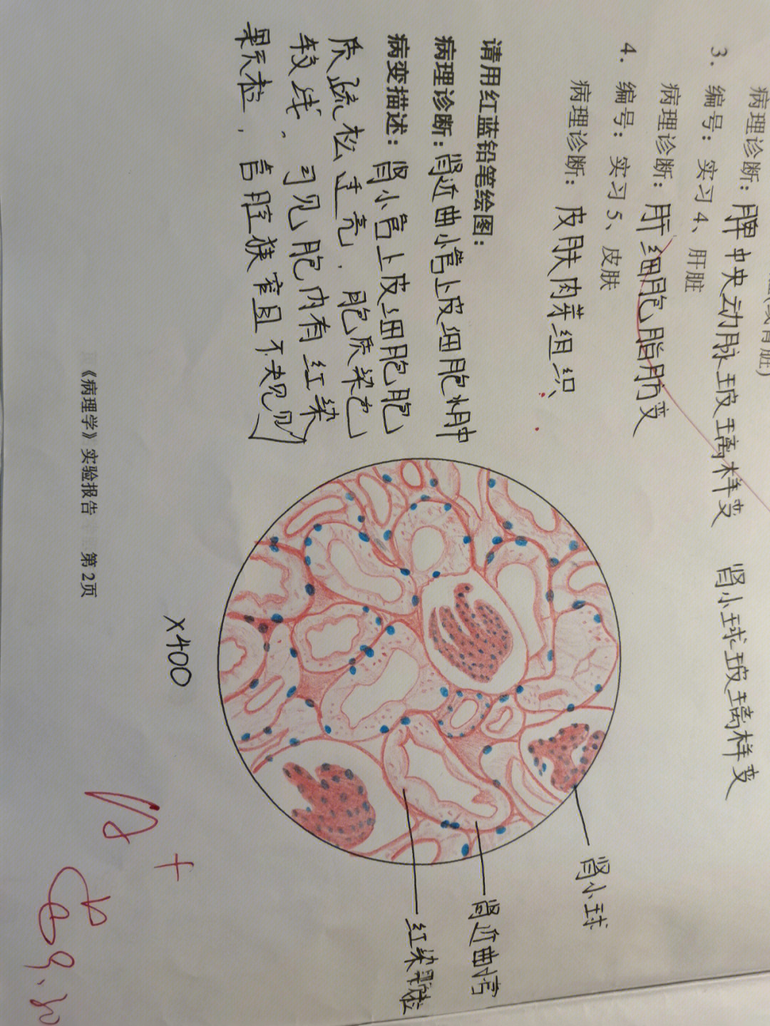 中性粒细胞红蓝铅笔图片