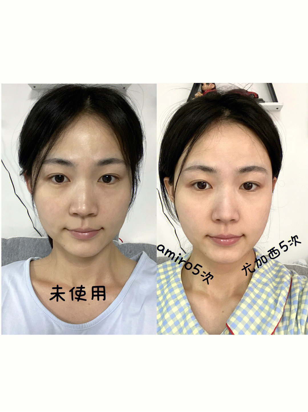 amiro尤加西美容仪10天使用对比有效果吗