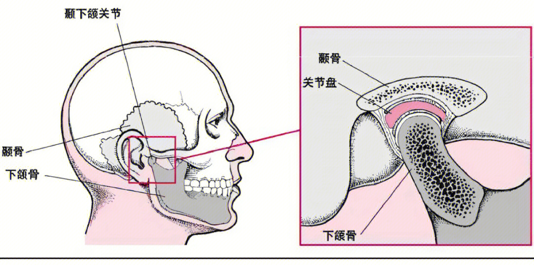 颞下颌关节紊乱