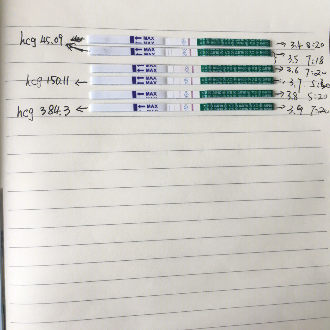 2000单位hcg代谢5天图图片