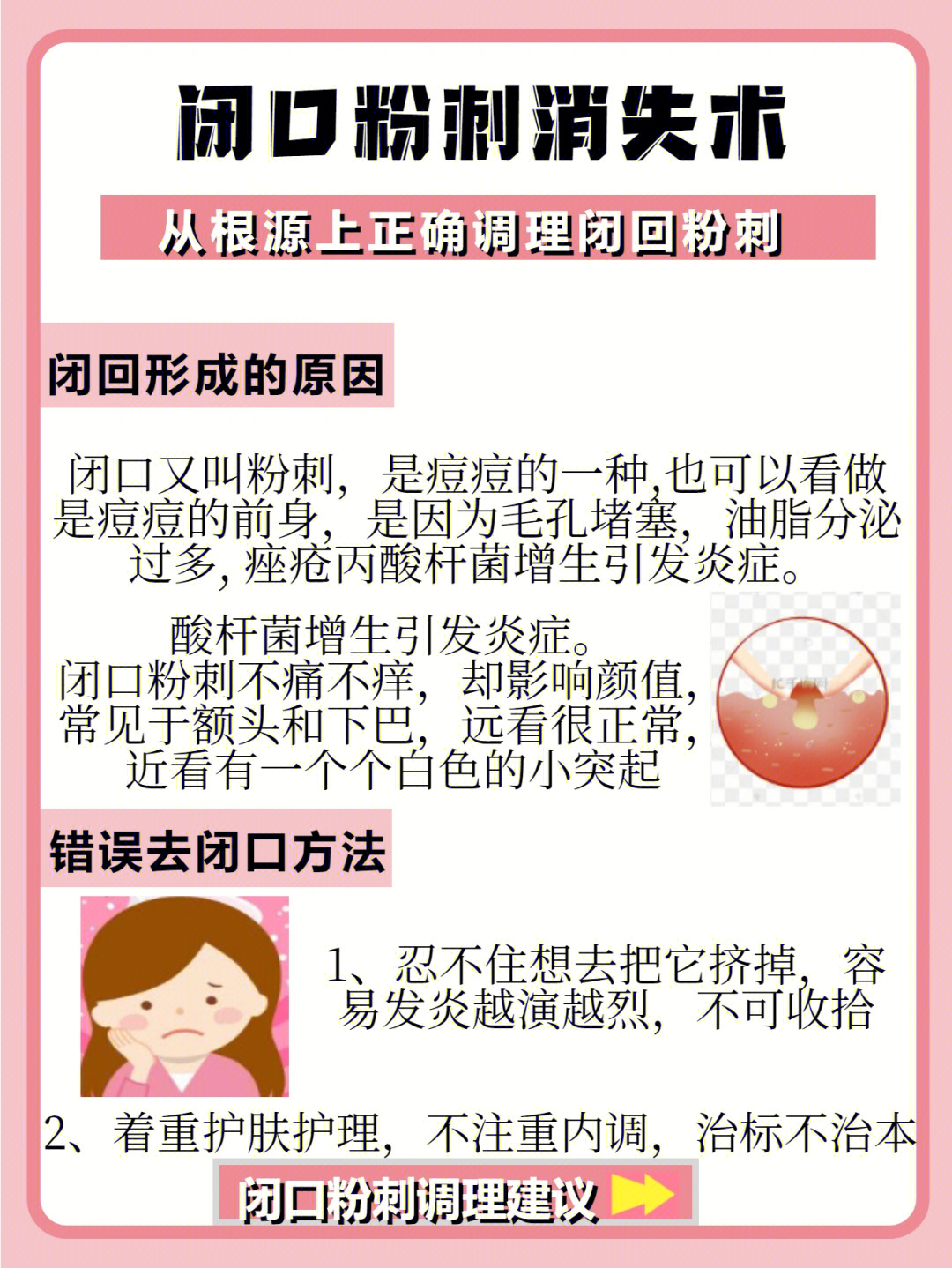 粉刺怎么去除小妙招图片