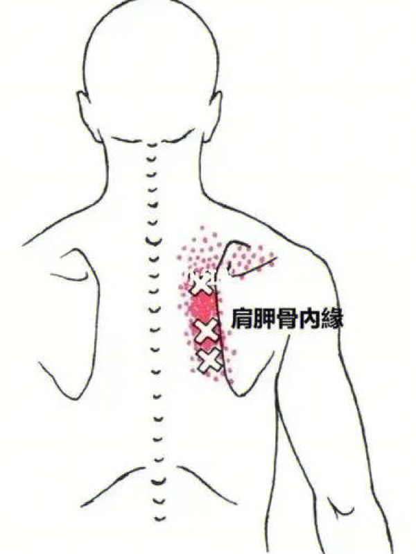肩胛骨反射区图片