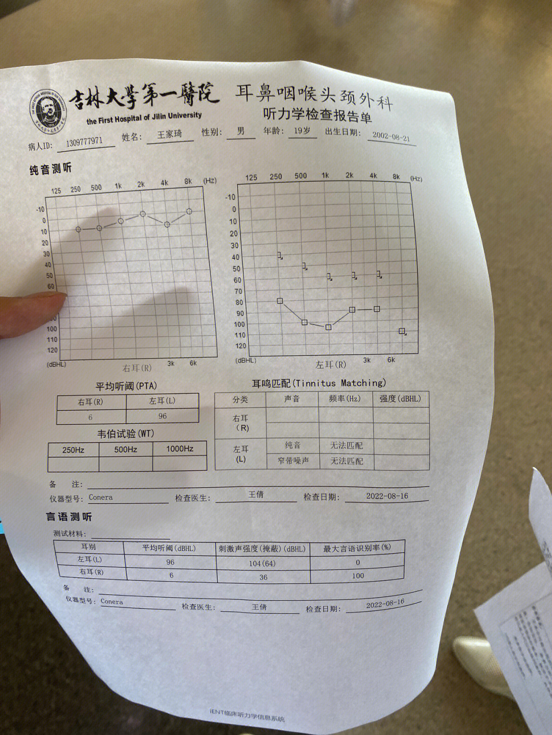 突聋耳后注射位置图图片