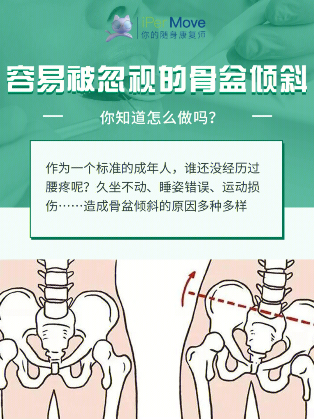 骨盆错位的症状图片