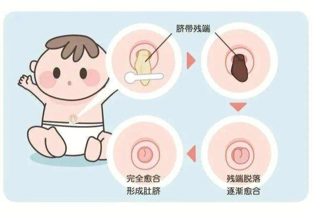 新生儿脐带的呵护及异常情况处理?