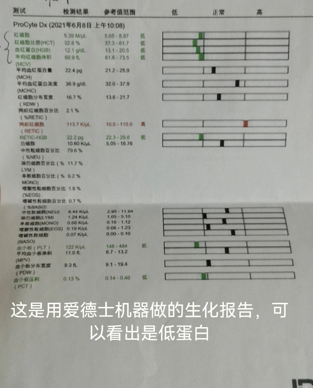 淋滞疏通丸治腹水案例图片