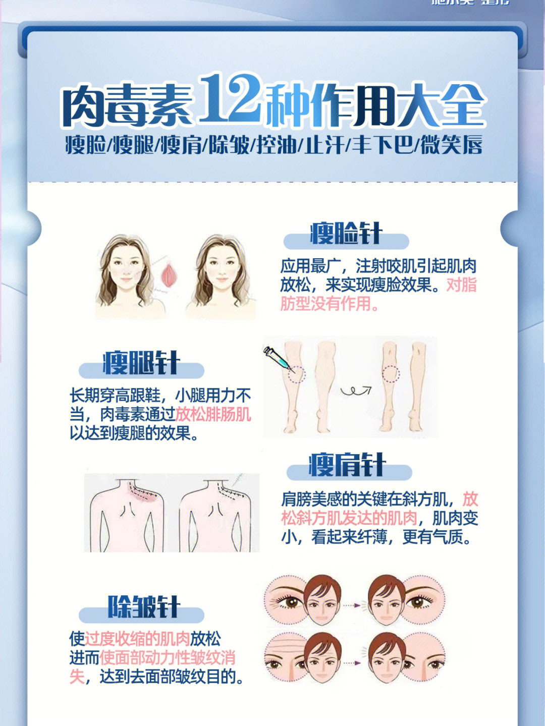 肉毒素注射方法图片