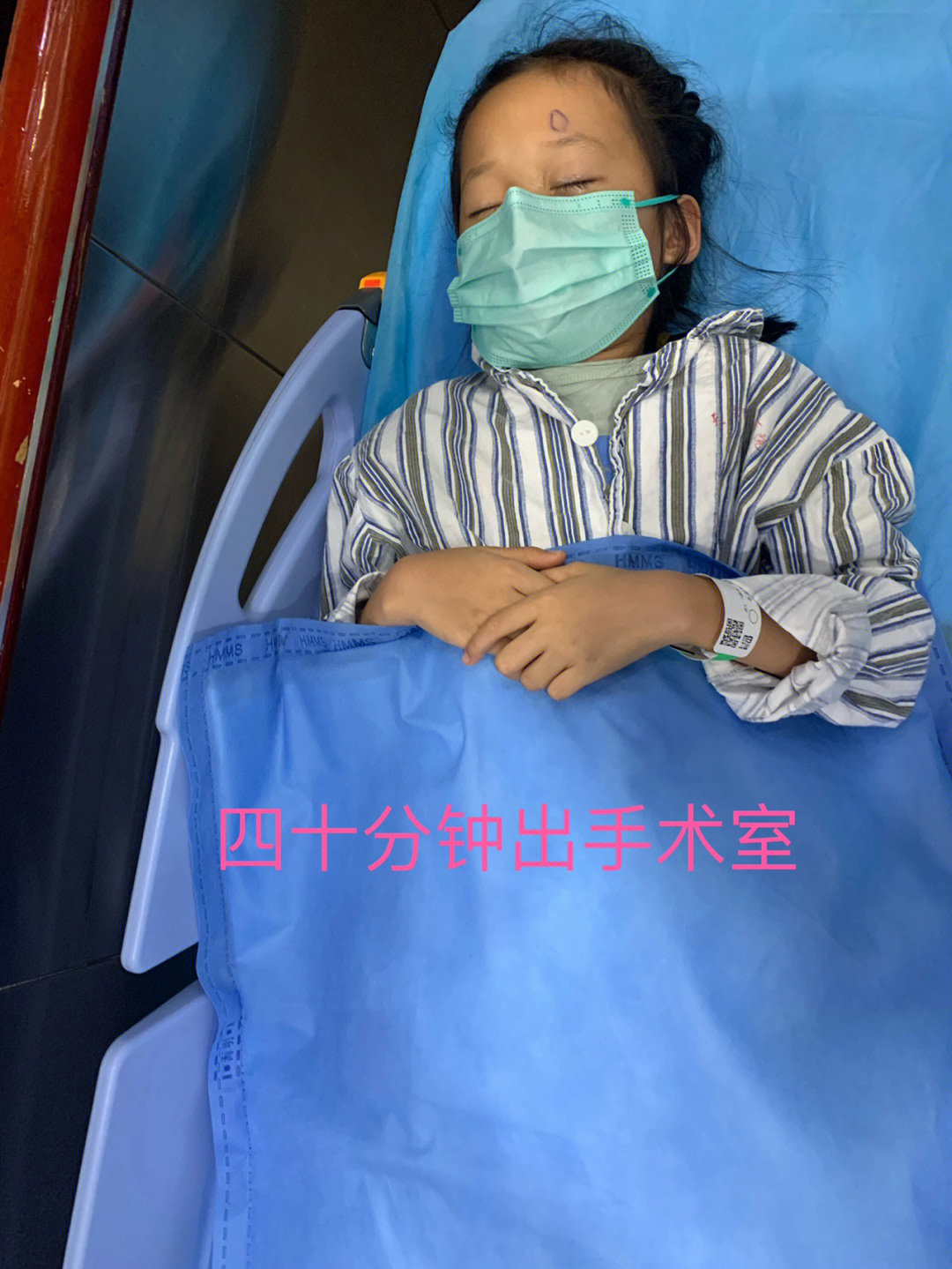 儿童斜视手术过程图片图片