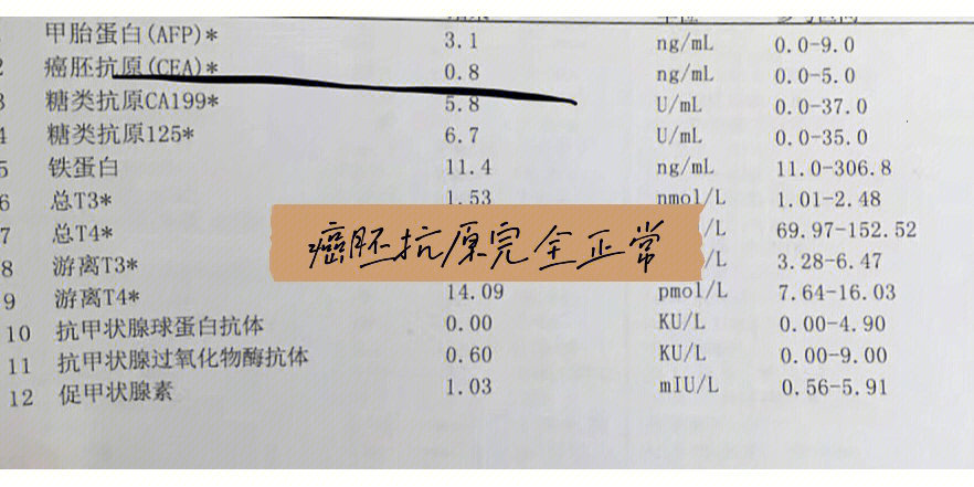 癌胚抗原图片图片