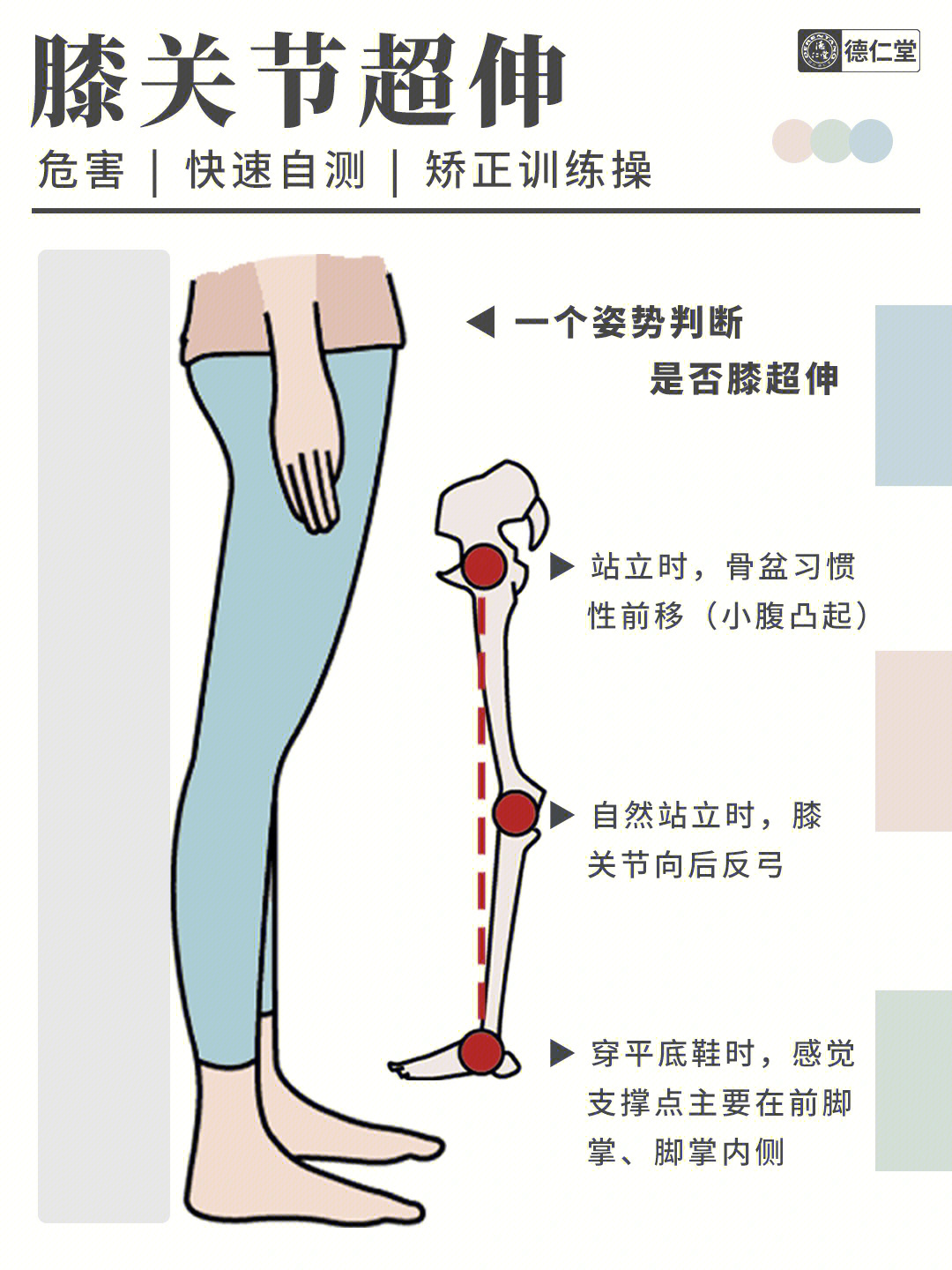 5个动作让腿型变直膝超伸腿粗肚子凸